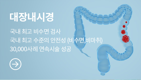 대장내시경